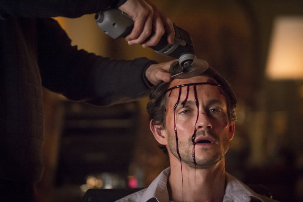 HANNIBAL -- "Dolce" Episode 306 -- (Photo by: Ian Watson/NBC)